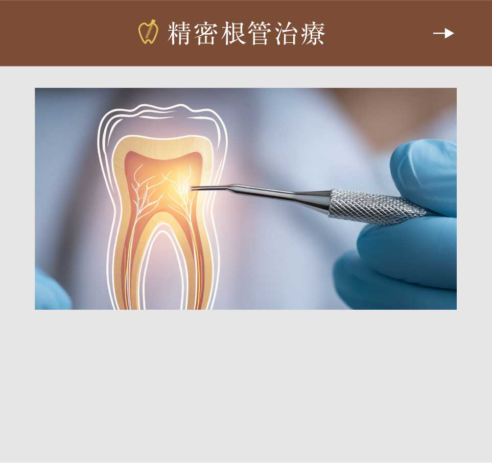 精密根管治療