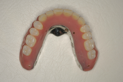 八潮市の歯医者で入れ歯をお探しなら「BiVi歯科・矯正歯科」