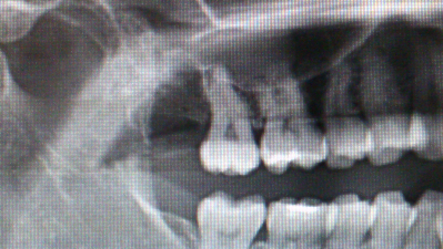 CT撮影完備の歯医者は「BiVi歯科・矯正歯科」