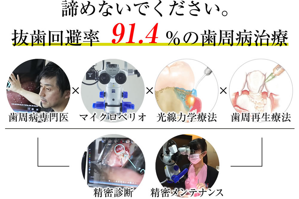 歯周病のメンテナンス