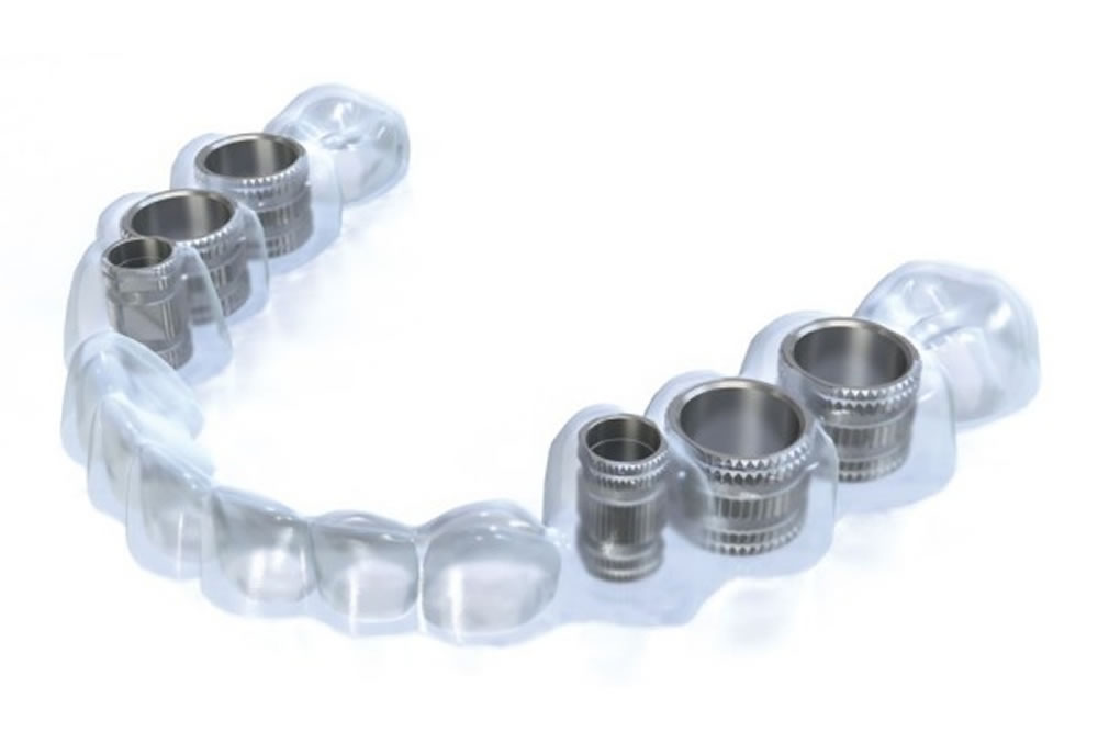 サージカルガイドの使用