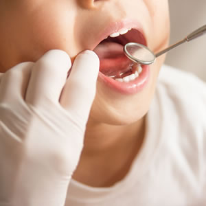 小児矯正・小児歯科