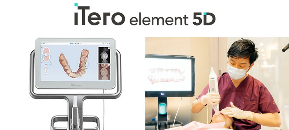 3D光学スキャナーiTero エレメント5Dplus