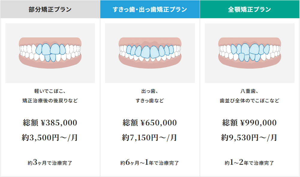 インビザラインプラン