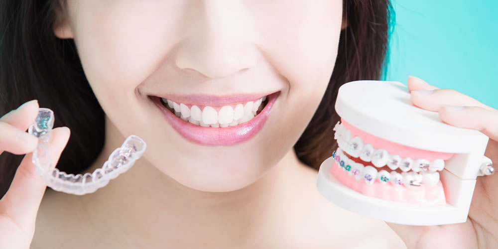 ハイブリッド矯正